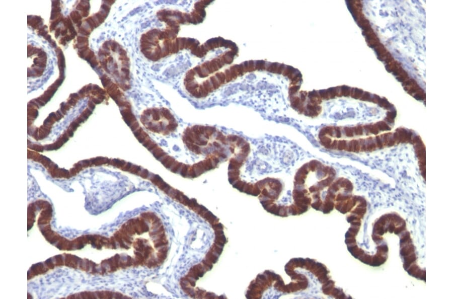 Immunohistochemistry - Anti-Cytokeratin 7 Antibody [KRT7/760] - BSA and Azide free (A252319) - Antibodies.com