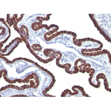 Immunohistochemistry - Anti-Cytokeratin 7 Antibody [KRT7/760] - BSA and Azide free (A252319) - Antibodies.com