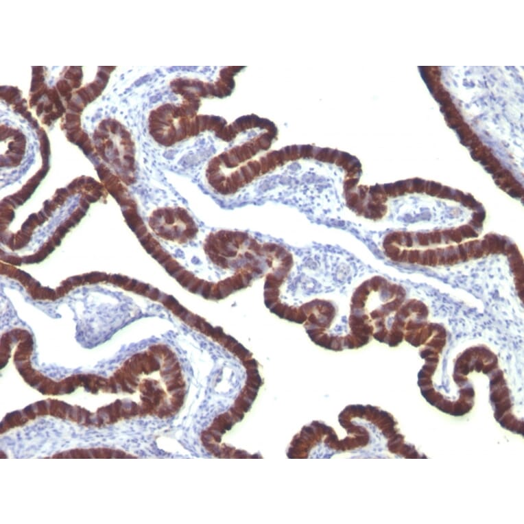 Immunohistochemistry - Anti-Cytokeratin 7 Antibody [KRT7/760] - BSA and Azide free (A252319) - Antibodies.com