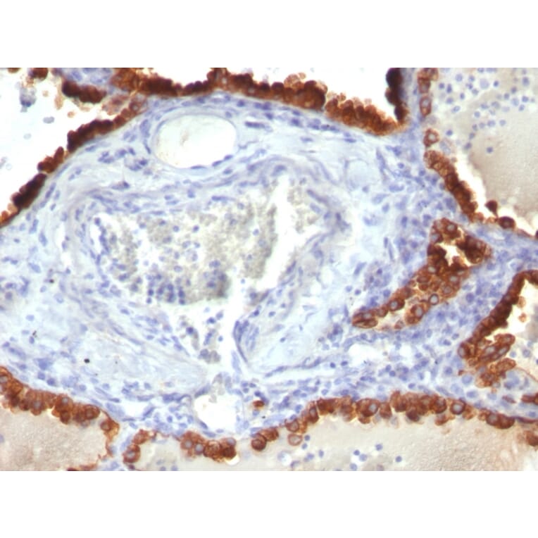 Immunohistochemistry - Anti-Cytokeratin 7 Antibody [KRT7/760] - BSA and Azide free (A252319) - Antibodies.com