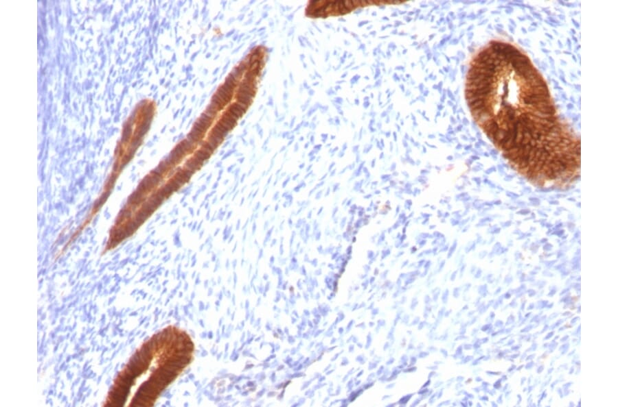 Immunohistochemistry - Anti-Cytokeratin 7 Antibody [KRT7/760] - BSA and Azide free (A252319) - Antibodies.com