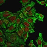 Immunofluorescence - Anti-Cytokeratin 7 Antibody [KRT7/760] - BSA and Azide free (A252319) - Antibodies.com