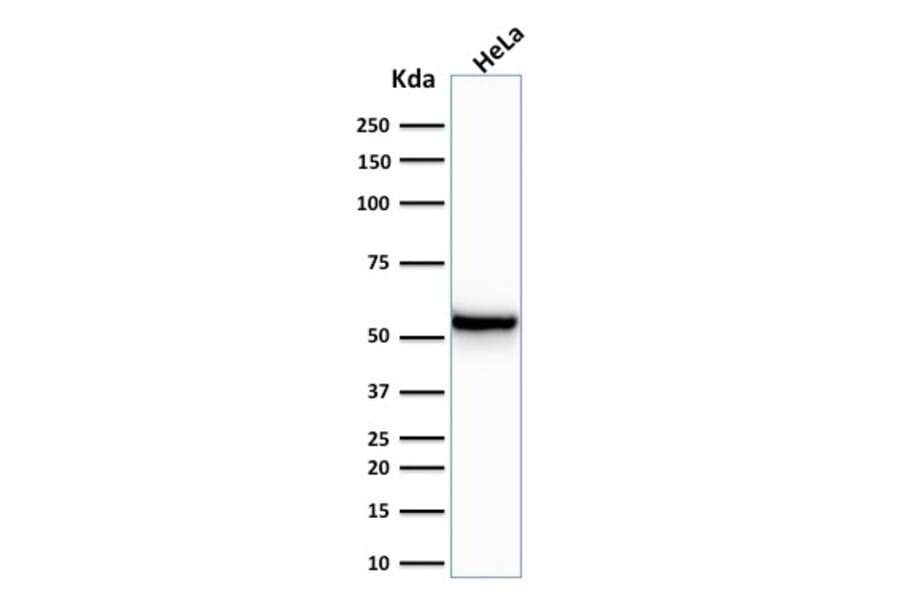 Western Blot - Anti-Cytokeratin 7 Antibody [KRT7/760] - BSA and Azide free (A252319) - Antibodies.com