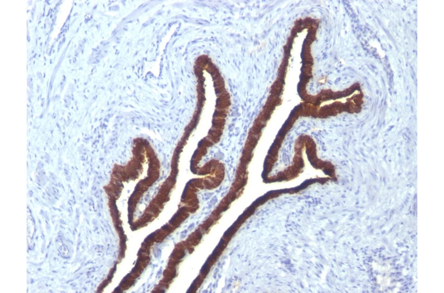 Immunohistochemistry - Anti-Cytokeratin 7 Antibody [KRT7/760 + KRT7/903] - BSA and Azide free (A252320) - Antibodies.com
