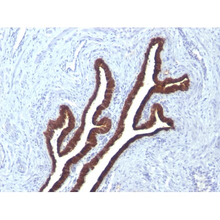 Immunohistochemistry - Anti-Cytokeratin 7 Antibody [KRT7/760 + KRT7/903] - BSA and Azide free (A252320) - Antibodies.com