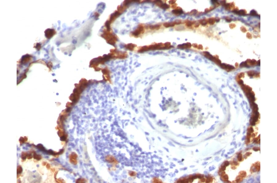 Immunohistochemistry - Anti-Cytokeratin 7 Antibody [KRT7/760 + KRT7/903] - BSA and Azide free (A252320) - Antibodies.com