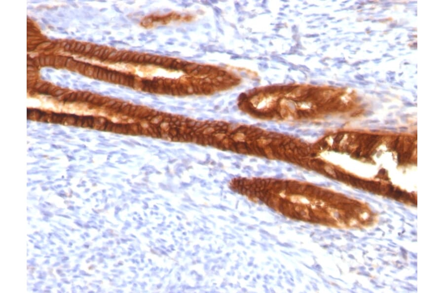 Immunohistochemistry - Anti-Cytokeratin 7 Antibody [KRT7/760 + KRT7/903] - BSA and Azide free (A252320) - Antibodies.com
