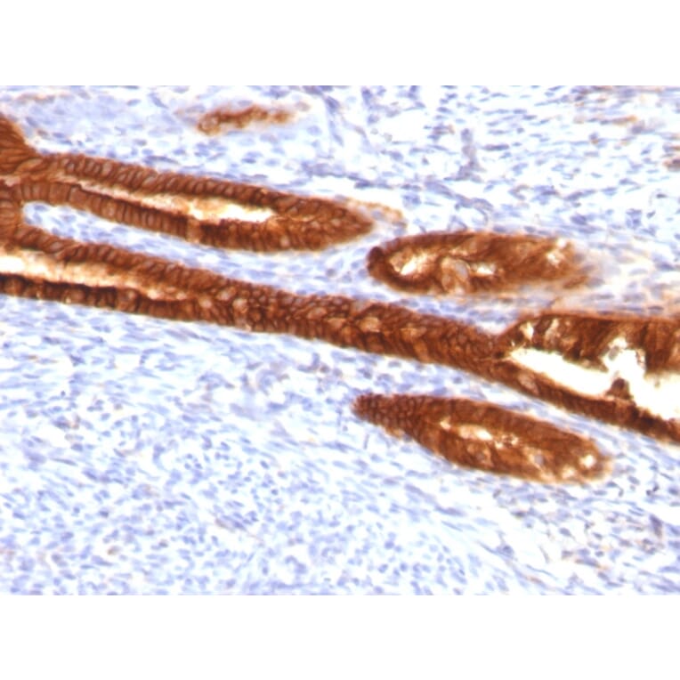 Immunohistochemistry - Anti-Cytokeratin 7 Antibody [KRT7/760 + KRT7/903] - BSA and Azide free (A252320) - Antibodies.com