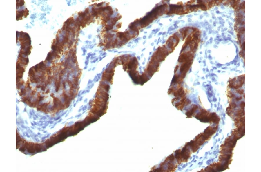 Immunohistochemistry - Anti-Cytokeratin 7 Antibody [KRT7/760 + OV-TL12/30] - BSA and Azide free (A252321) - Antibodies.com