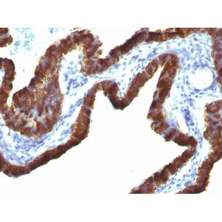 Immunohistochemistry - Anti-Cytokeratin 7 Antibody [KRT7/760 + OV-TL12/30] - BSA and Azide free (A252321) - Antibodies.com