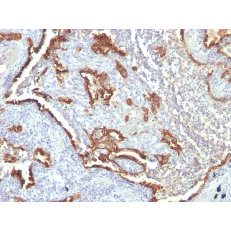 Immunohistochemistry - Anti-Cytokeratin 7 Antibody [KRT7/760 + OV-TL12/30] - BSA and Azide free (A252321) - Antibodies.com
