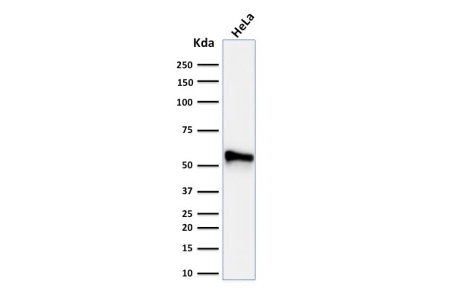 Western Blot - Anti-Cytokeratin 7 Antibody [KRT7/760 + OV-TL12/30] - BSA and Azide free (A252321) - Antibodies.com