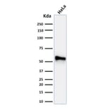 Western Blot - Anti-Cytokeratin 7 Antibody [KRT7/760 + OV-TL12/30] - BSA and Azide free (A252321) - Antibodies.com