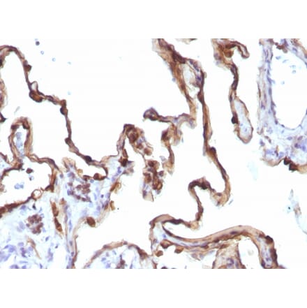 Immunohistochemistry - Anti-Cytokeratin 7 Antibody [KRT7/1198] - BSA and Azide free (A252322) - Antibodies.com