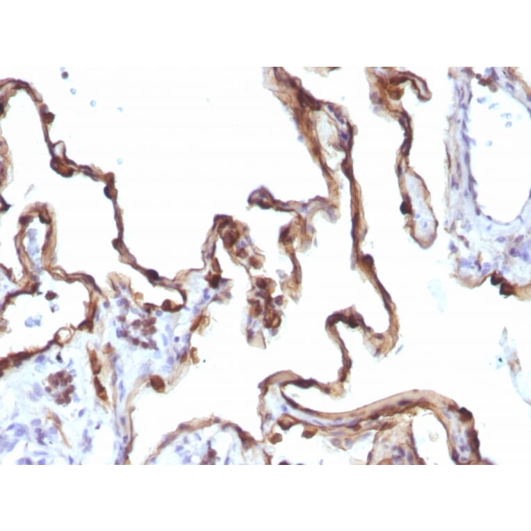 Immunohistochemistry - Anti-Cytokeratin 7 Antibody [KRT7/1198] - BSA and Azide free (A252322) - Antibodies.com