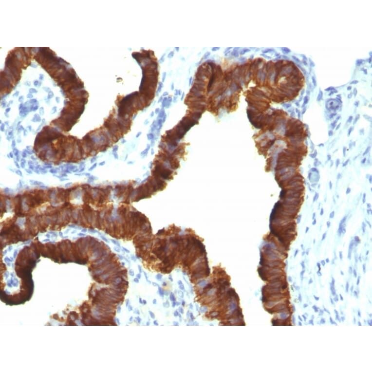 Immunohistochemistry - Anti-Cytokeratin 7 Antibody [KRT7/1198] - BSA and Azide free (A252322) - Antibodies.com