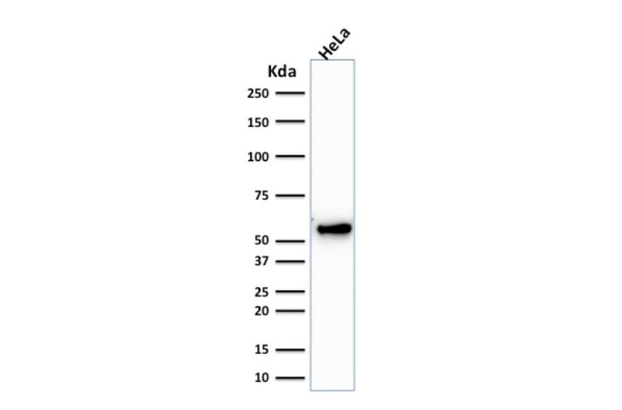 Western Blot - Anti-Cytokeratin 7 Antibody [KRT7/1198] - BSA and Azide free (A252322) - Antibodies.com