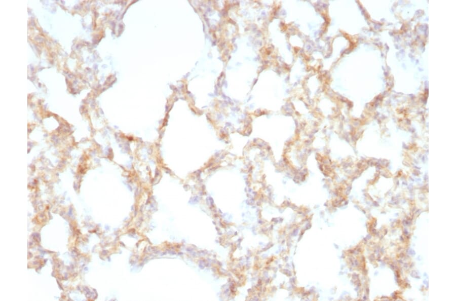 Immunohistochemistry - Anti-Cytokeratin 7 Antibody [KRT7/1198] - BSA and Azide free (A252322) - Antibodies.com