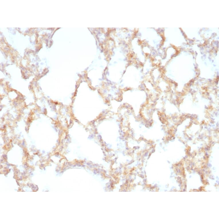 Immunohistochemistry - Anti-Cytokeratin 7 Antibody [KRT7/1198] - BSA and Azide free (A252322) - Antibodies.com