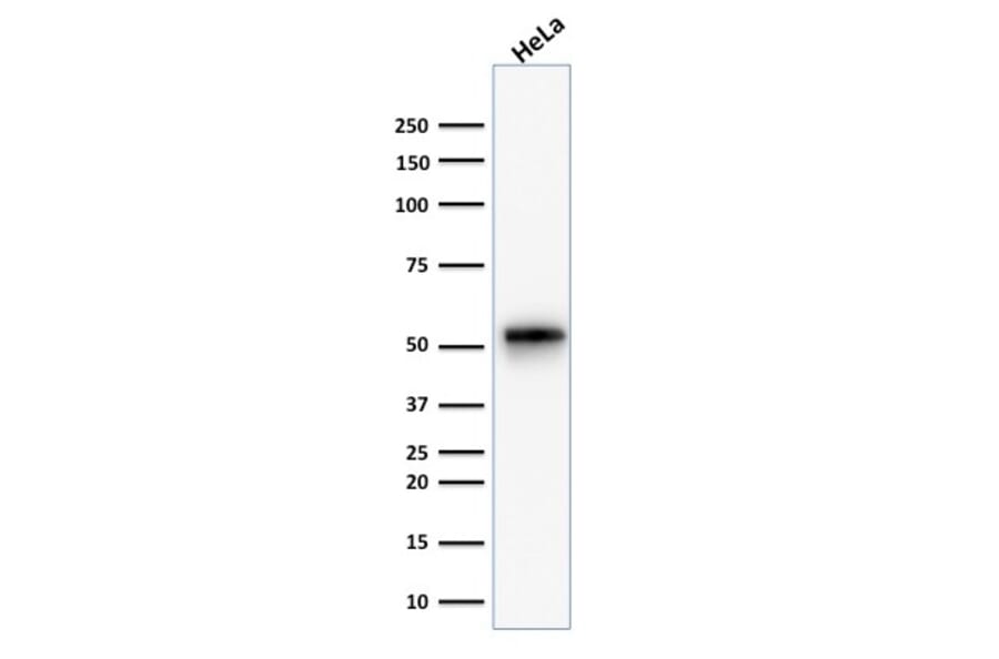 Western Blot - Anti-Cytokeratin 7 Antibody [KRT7/1499R] - BSA and Azide free (A252323) - Antibodies.com