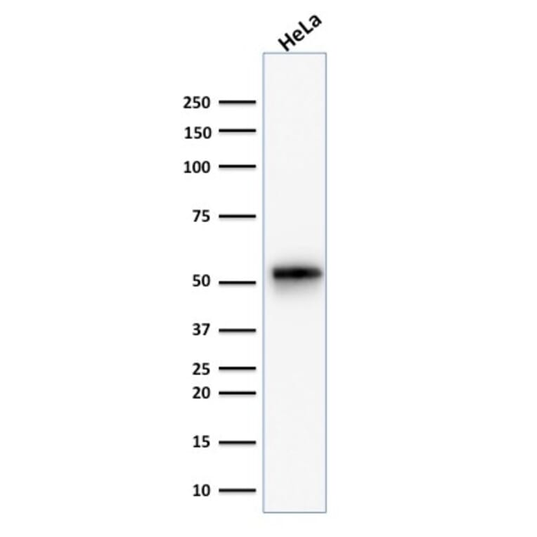 Western Blot - Anti-Cytokeratin 7 Antibody [KRT7/1499R] - BSA and Azide free (A252323) - Antibodies.com