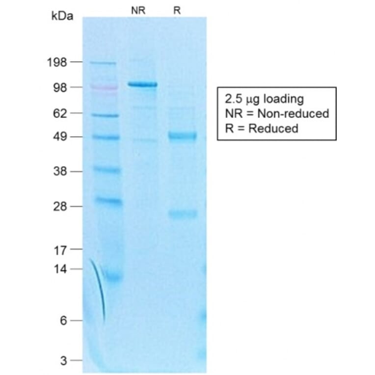 SDS-PAGE - Anti-Cytokeratin 7 Antibody [KRT7/1499R] - BSA and Azide free (A252323) - Antibodies.com