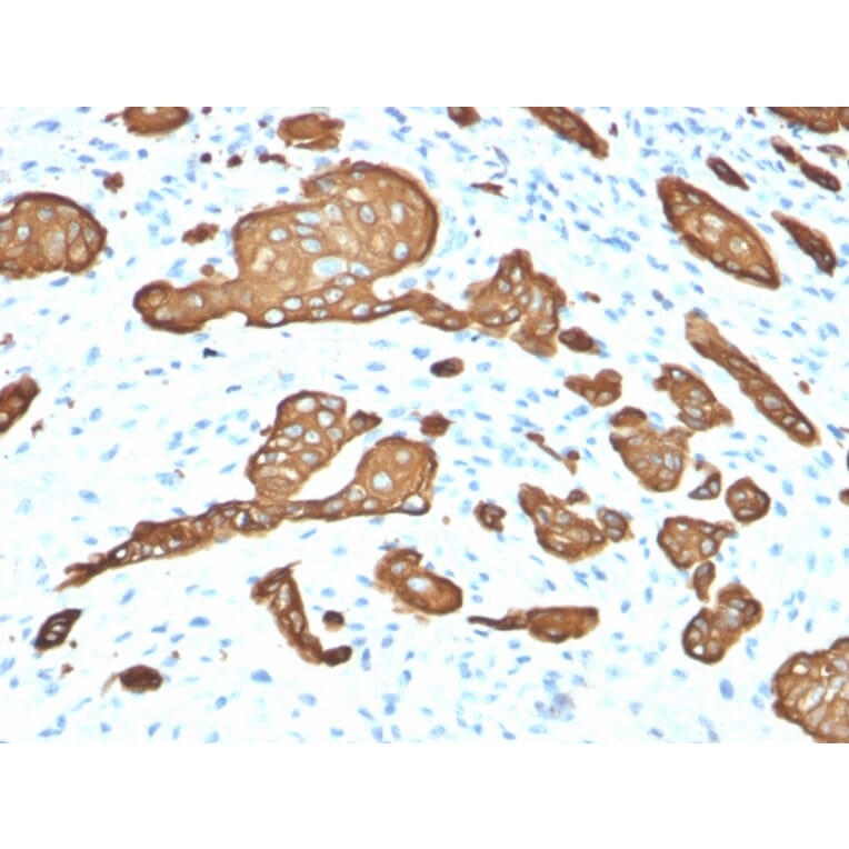 Immunohistochemistry - Anti-Cytokeratin 8 Antibody [KRT8/2115] - BSA and Azide free (A252325) - Antibodies.com