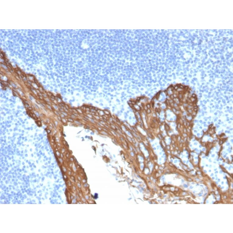 Immunohistochemistry - Anti-Cytokeratin 8 Antibody [KRT8/2115] - BSA and Azide free (A252325) - Antibodies.com