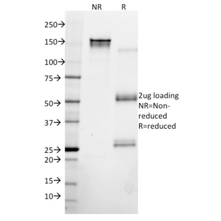 SDS-PAGE - Anti-Cytokeratin 8 Antibody [KRT8/2115] - BSA and Azide free (A252325) - Antibodies.com