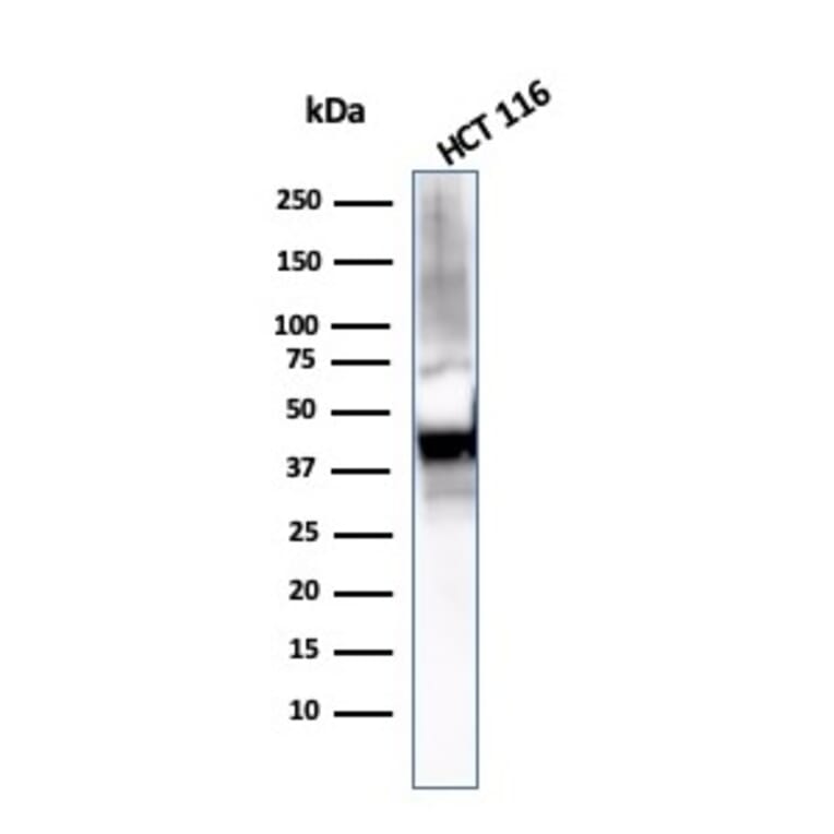 Western Blot - Anti-Cytokeratin 8 Antibody [KRT8/2115] - BSA and Azide free (A252325) - Antibodies.com