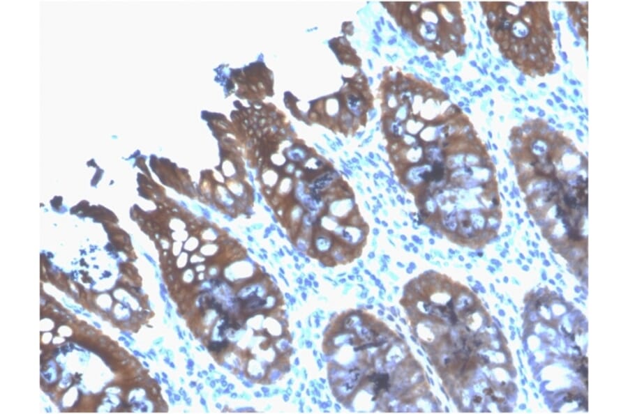 Immunohistochemistry - Anti-Cytokeratin 8 Antibody [rB22.1] - BSA and Azide free (A252325) - Antibodies.com
