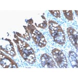 Immunohistochemistry - Anti-Cytokeratin 8 Antibody [rB22.1] - BSA and Azide free (A252325) - Antibodies.com