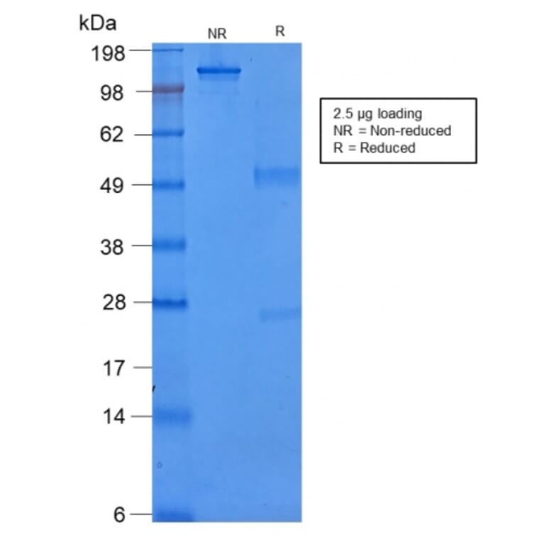SDS-PAGE - Anti-Cytokeratin 8 Antibody [rB22.1] - BSA and Azide free (A252326) - Antibodies.com