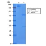 SDS-PAGE - Anti-Cytokeratin 8 Antibody [rB22.1] - BSA and Azide free (A252326) - Antibodies.com