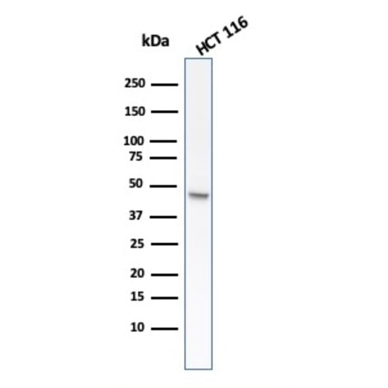 Western Blot - Anti-Cytokeratin 8 Antibody [rB22.1] - BSA and Azide free (A252326) - Antibodies.com