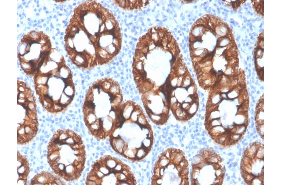 Immunohistochemistry - Anti-Cytokeratin 8 Antibody [rKRT8/4209] - BSA and Azide free (A252326) - Antibodies.com