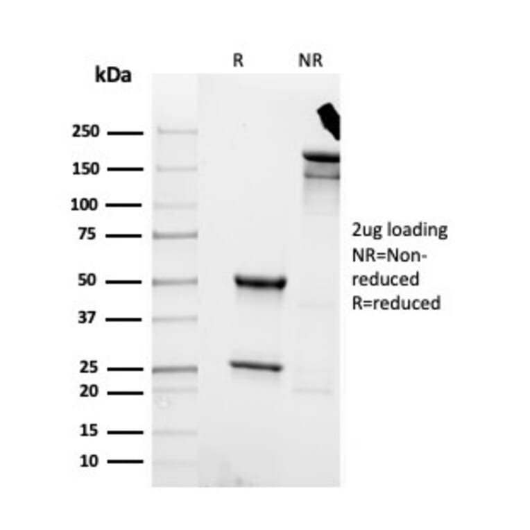 SDS-PAGE - Anti-Cytokeratin 8 Antibody [rKRT8/4209] - BSA and Azide free (A252327) - Antibodies.com