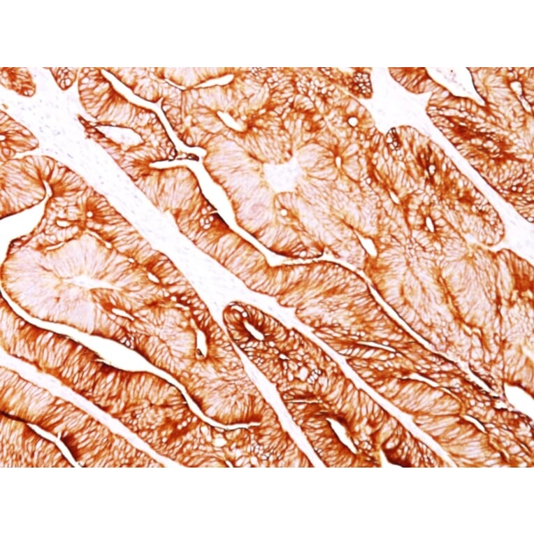 Immunohistochemistry - Anti-Cytokeratin 8 Antibody [H1] - BSA and Azide free (A252328) - Antibodies.com