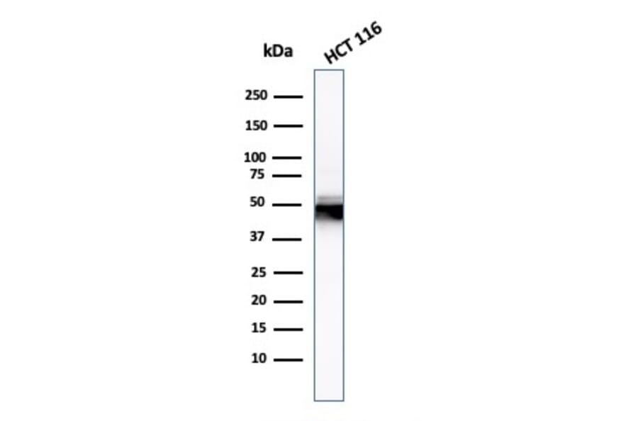 Western Blot - Anti-Cytokeratin 8 Antibody [H1] - BSA and Azide free (A252328) - Antibodies.com