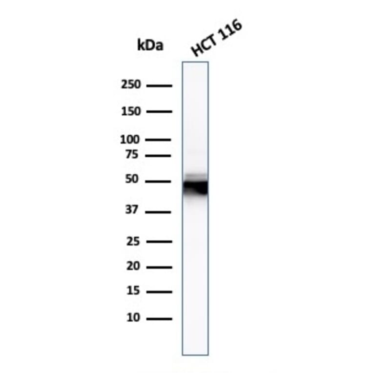 Western Blot - Anti-Cytokeratin 8 Antibody [H1] - BSA and Azide free (A252328) - Antibodies.com