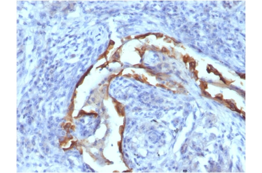 Immunohistochemistry - Anti-Cytokeratin 8 Antibody [SPM538] - BSA and Azide free (A252329) - Antibodies.com