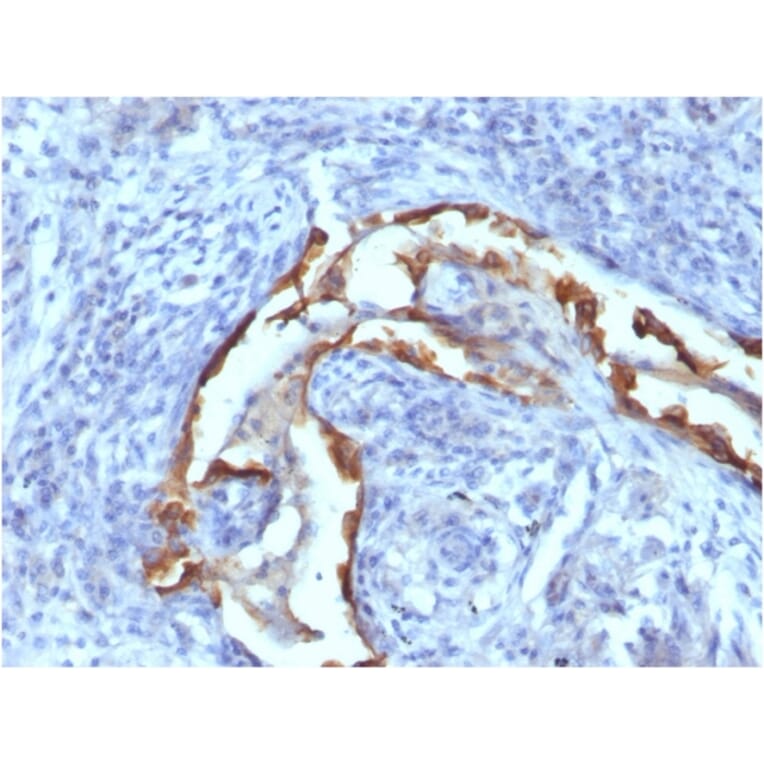 Immunohistochemistry - Anti-Cytokeratin 8 Antibody [SPM538] - BSA and Azide free (A252329) - Antibodies.com