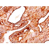 Immunohistochemistry - Anti-Cytokeratin 8 Antibody [TS1] - BSA and Azide free (A252331) - Antibodies.com