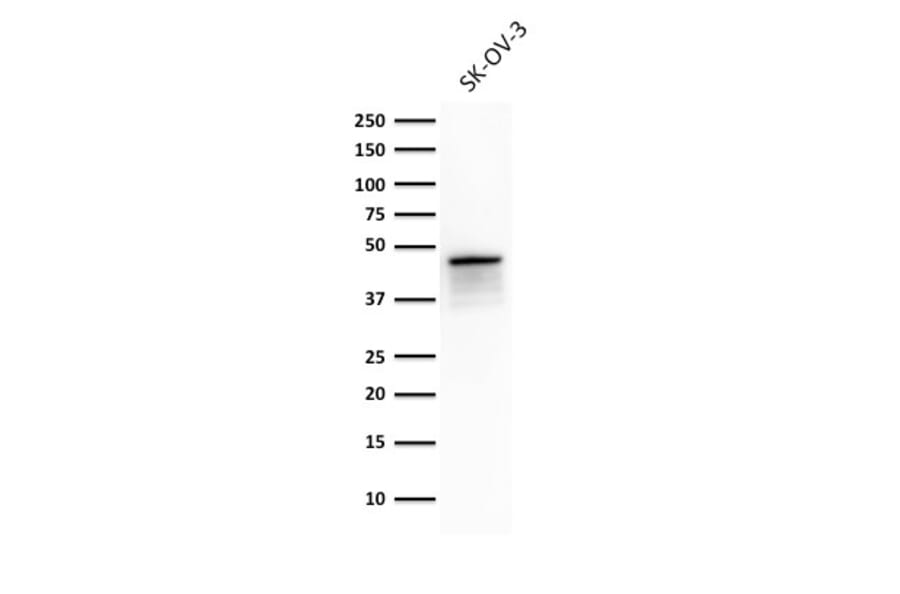 Western Blot - Anti-Cytokeratin 8 Antibody [TS1] - BSA and Azide free (A252331) - Antibodies.com