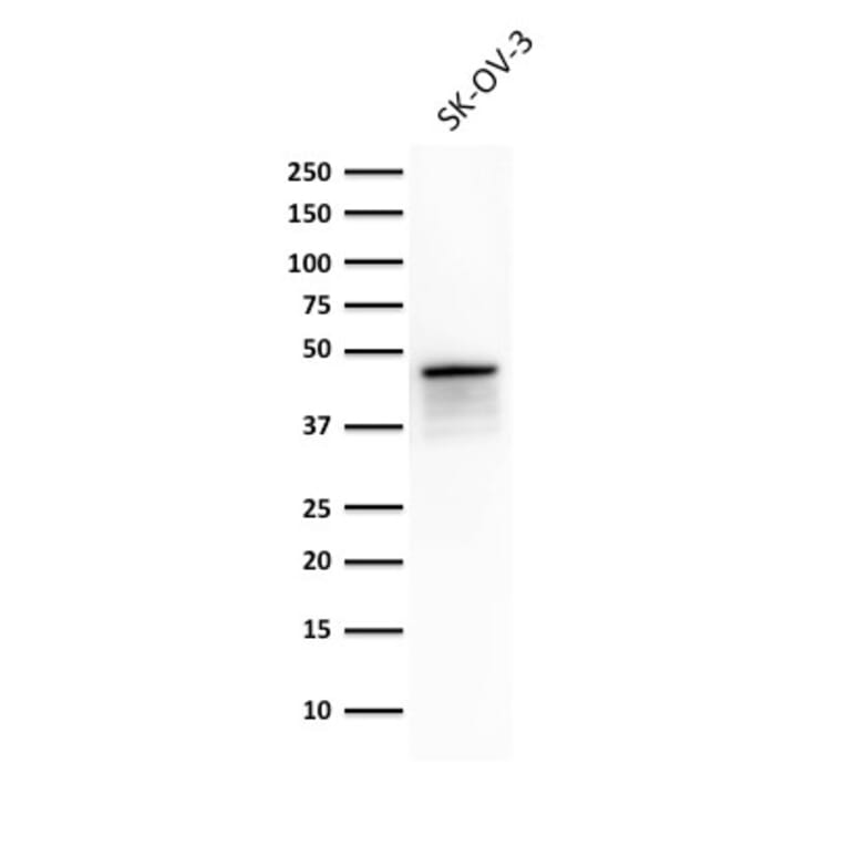 Western Blot - Anti-Cytokeratin 8 Antibody [TS1] - BSA and Azide free (A252331) - Antibodies.com