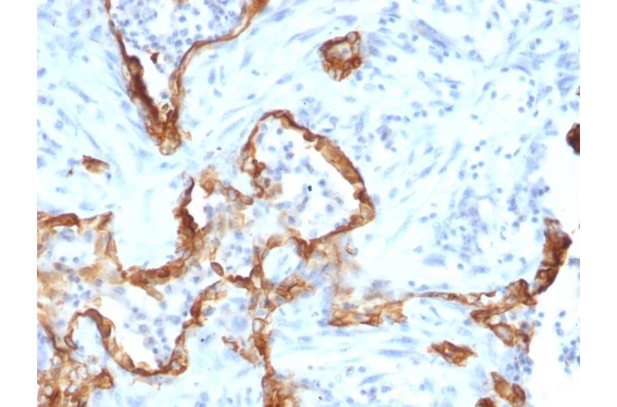 Immunohistochemistry - Anti-Cytokeratin 8 Antibody [SPM192] - BSA and Azide free (A252332) - Antibodies.com