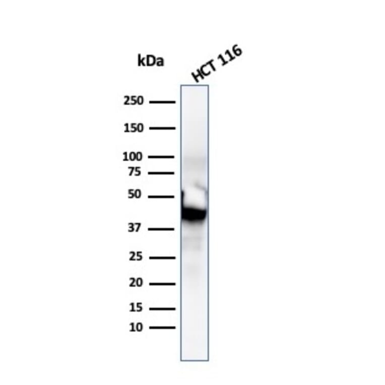 Western Blot - Anti-Cytokeratin 8 Antibody [SPM192] - BSA and Azide free (A252332) - Antibodies.com