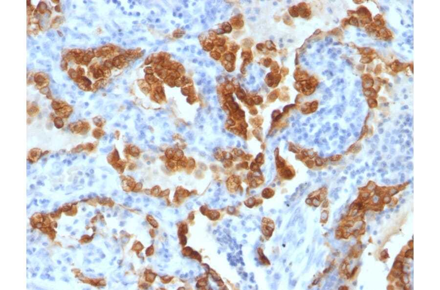 Immunohistochemistry - Anti-Cytokeratin 8 Antibody [H1+TS1] - BSA and Azide free (A252333) - Antibodies.com