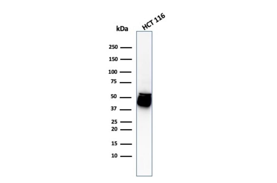 Western Blot - Anti-Cytokeratin 8 Antibody [H1+TS1] - BSA and Azide free (A252333) - Antibodies.com