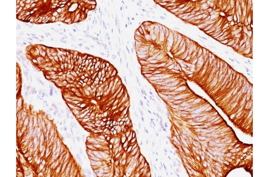 Immunohistochemistry - Anti-Cytokeratin 8 Antibody [K8.8] - BSA and Azide free (A252335) - Antibodies.com